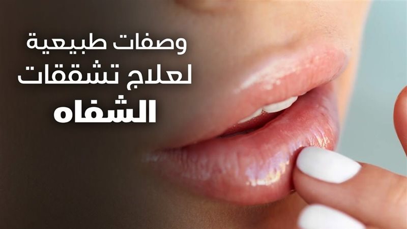 ترطيب الشفاه بالمواد
