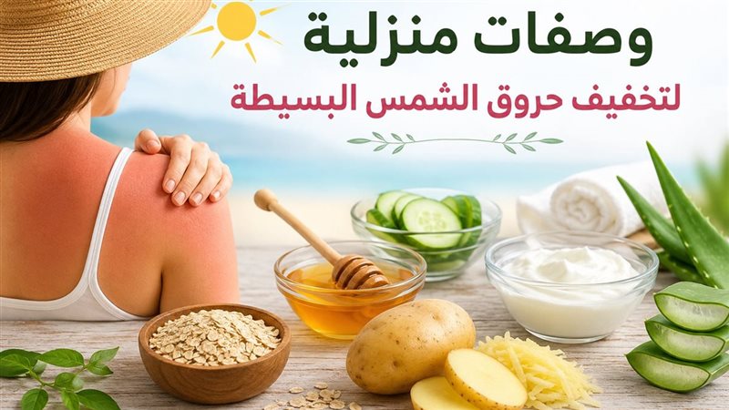 وصفات لعلاج حروق