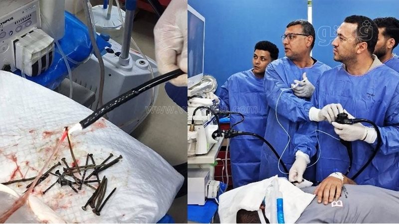 استخراج 100 مسمار
