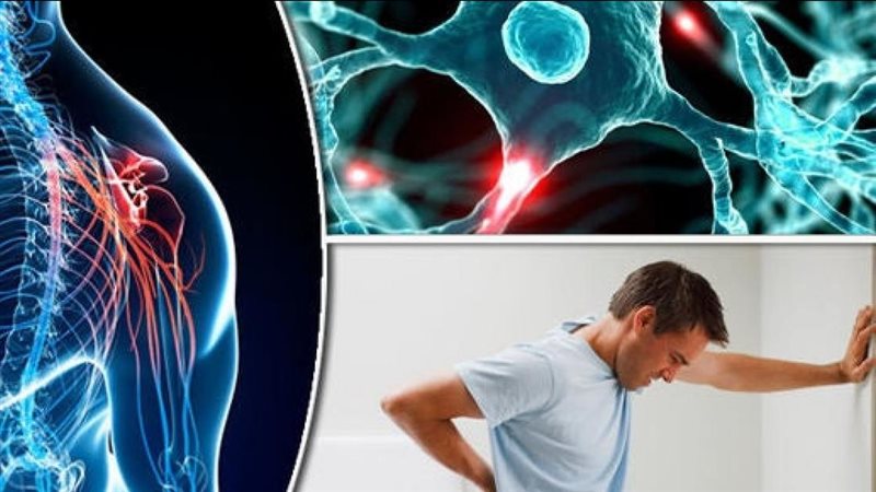 مرض التصلب المتعدد