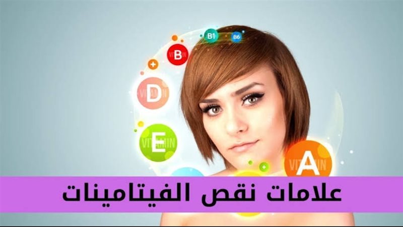 علامات نقص الفيتامينات