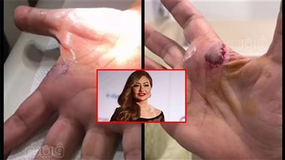 أخبار مصر| بيان كورونا.. حالة الطقس.. ليلى علوي تكشف تفاصيل إصابتها.. كيفية استخراج قيد عائلي من البريد.. الذهب يتجاوز 2000 دولار للأوقية