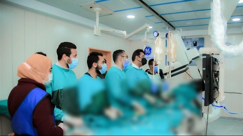 وحدة الصدمات المخية