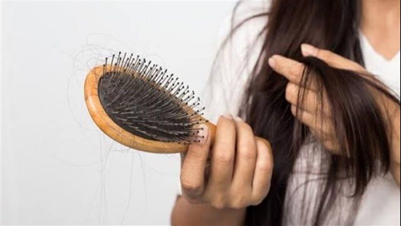 تساقط الشعر 