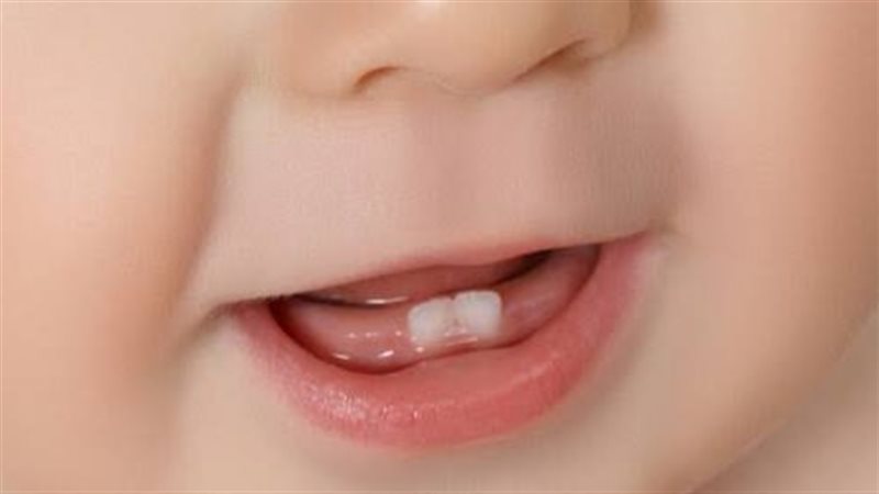 أسنان الأطفال، فيتو