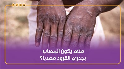 متى يكون المصاب بـ جدري القرود معديا؟| انفوجراف