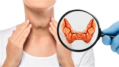 أعراض الغدة الدرقية.. وطرق العلاج بالنظام الغذائي