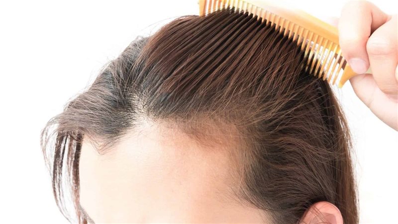 علاج لتساقط الشعر