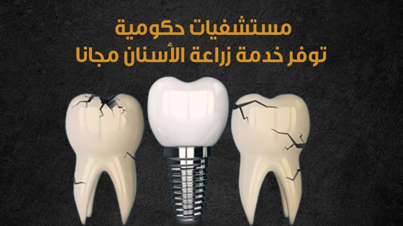زراعة الأسنان 